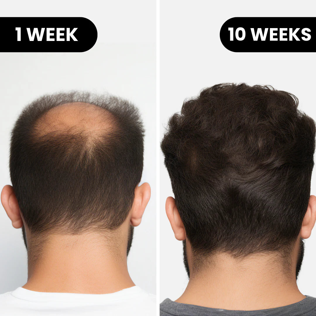 Glow From Earth's 'Alpha' Hair Regrowth System