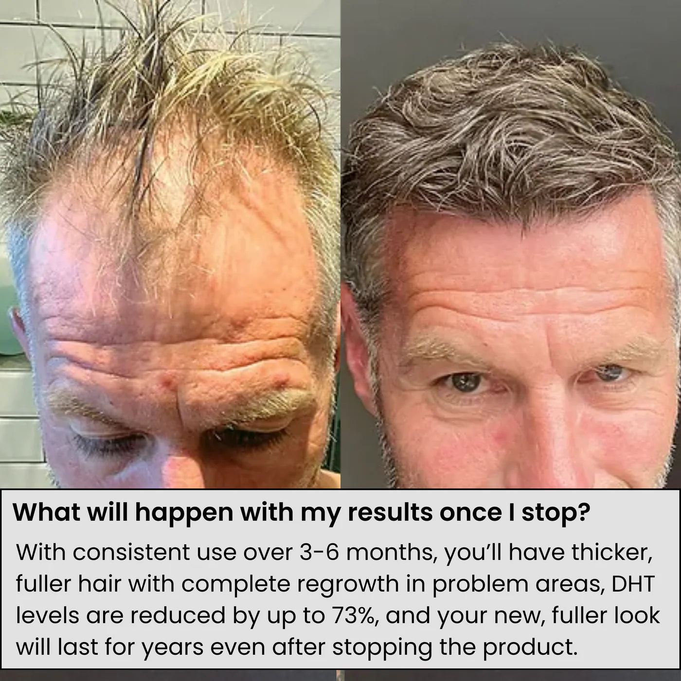 Glow From Earth's 'Alpha' Hair Regrowth System
