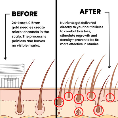 Glow From Earth's 'Alpha' Hair Regrowth System